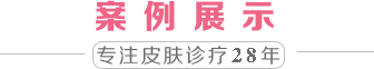 案例展示